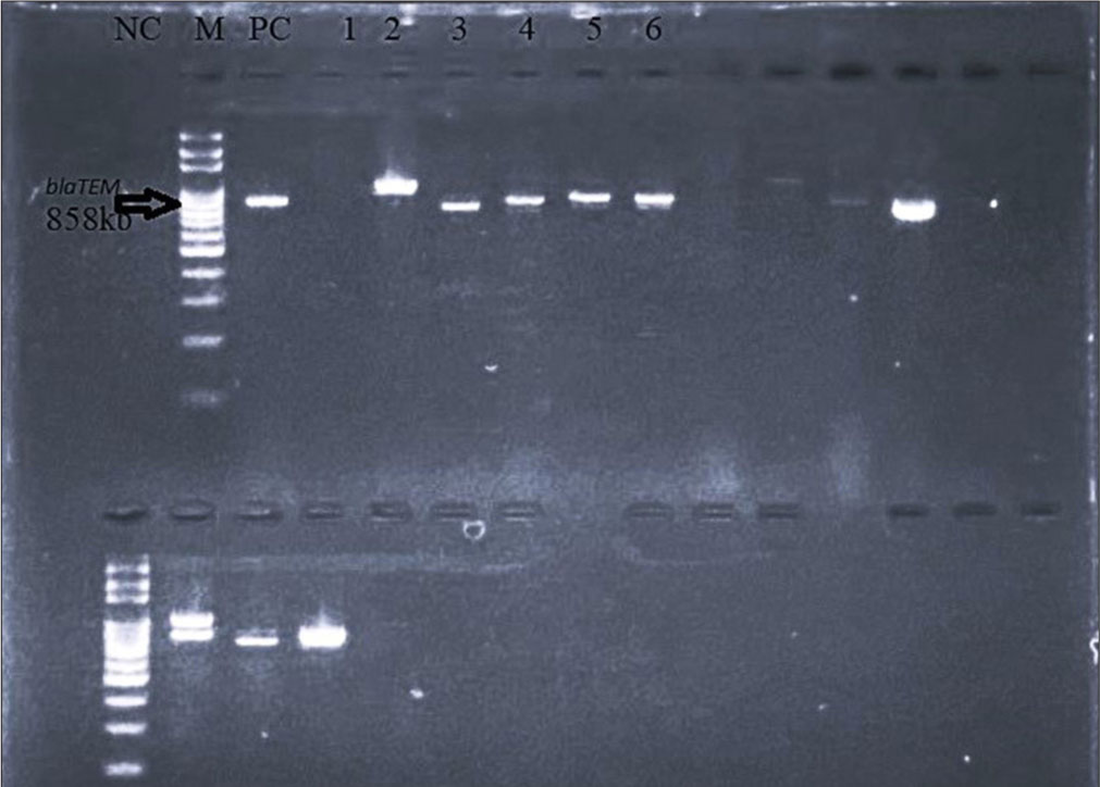 Gel picture showing blaTEM gene PCR products from Klebsiella pneumonia. Lane 1: Negative control, Lane 2: Marker, Lane 3: Positive control, Lanes 4-7: sample results.